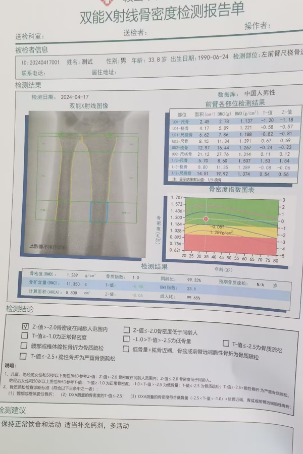 雙能X射線骨密度儀：準確測量骨密度，助力骨質疏松防治，守護骨骼健康